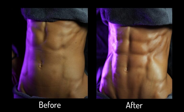 VS Abs Sculpting Therapy